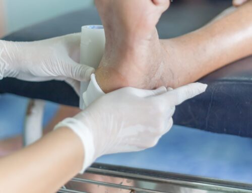 National Diabetes Month: The Importance of Wound Care in Diabetes Management