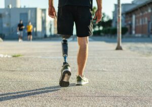 A man walking with a prosthetic leg.