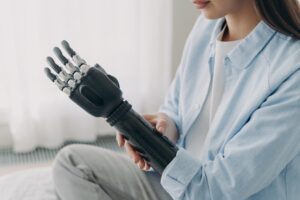 A woman touching her prosthetic arm.