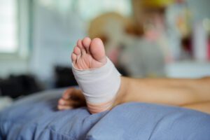 A bandaged foot resting on a pillow.