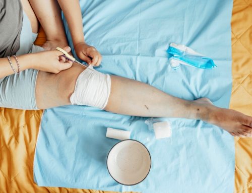 Tips for Preventing Wound Infections