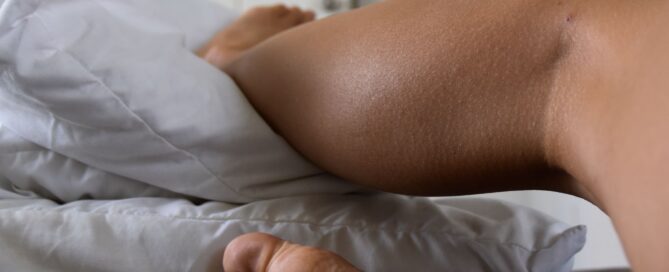 Leg elevated on pillows on a bed to reduce foot swelling